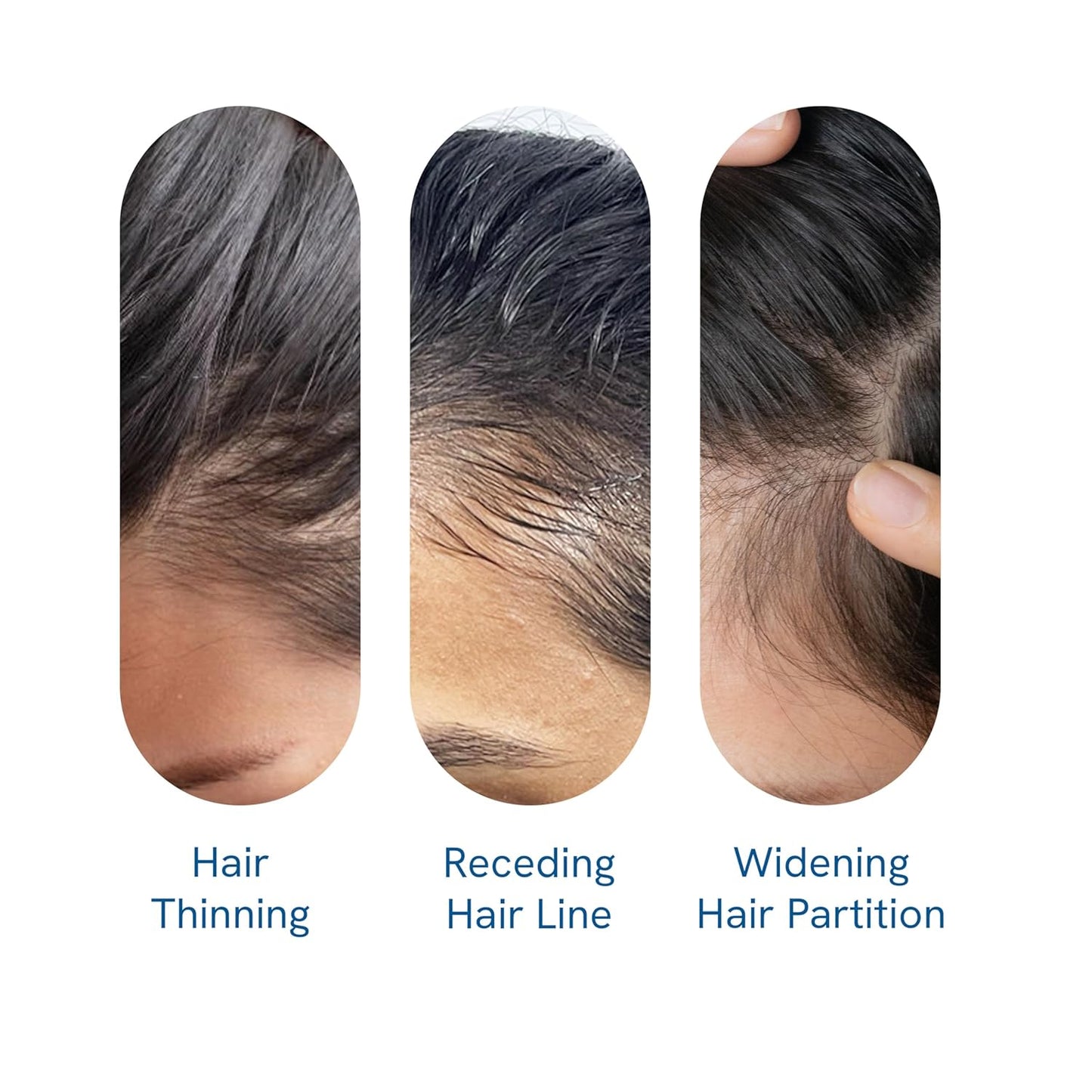🔥NOW 50% OFF!! 🔥NEGUSY Hair Growth Serum Roll-On: 🌿The Scalp-Supporting Solution for Thicker, Fuller Hair✨