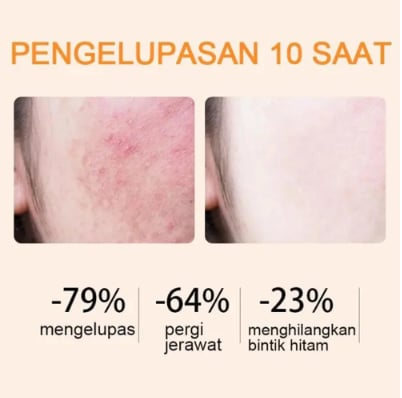 ✨Buy 2 Get 2 FREE 🍊Orange Enzyme Exfoliating Gel — Break Down Dead Skin, Unclog Pores & Reveal Baby-Smooth Skin