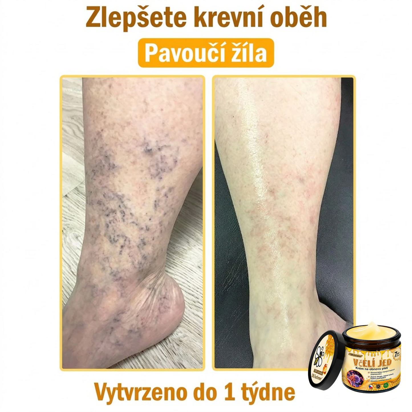 💖Dermatologicky a klinicky testováno👩‍⚕️LXNDS Bee Venom Krém na obnovení pleti🐝 pomáhá při léčbě kožních problémů, jako jsou: vrásky, jizvy, pigmentové skvrny, strie, akné, psoriáza, ekzém, kožní změny, podráždění, záněty a další kožní problémy.💖
