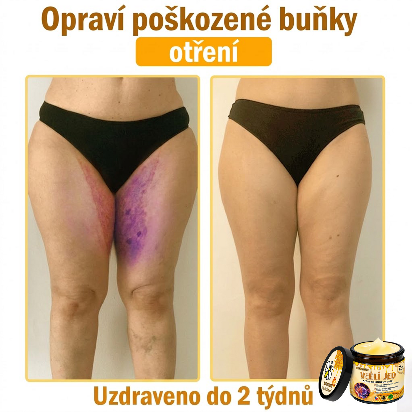 💖Dermatologicky a klinicky testováno👩‍⚕️LXNDS Bee Venom Krém na obnovení pleti🐝 pomáhá při léčbě kožních problémů, jako jsou: vrásky, jizvy, pigmentové skvrny, strie, akné, psoriáza, ekzém, kožní změny, podráždění, záněty a další kožní problémy.💖