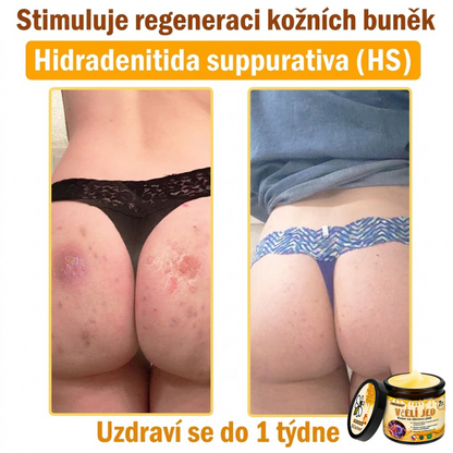 💖Dermatologicky a klinicky testováno👩‍⚕️LXNDS Bee Venom Krém na obnovení pleti🐝 pomáhá při léčbě kožních problémů, jako jsou: vrásky, jizvy, pigmentové skvrny, strie, akné, psoriáza, ekzém, kožní změny, podráždění, záněty a další kožní problémy.💖