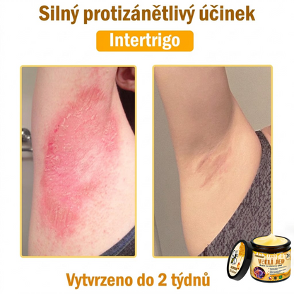 💖Dermatologicky a klinicky testováno👩‍⚕️LXNDS Bee Venom Krém na obnovení pleti🐝 pomáhá při léčbě kožních problémů, jako jsou: vrásky, jizvy, pigmentové skvrny, strie, akné, psoriáza, ekzém, kožní změny, podráždění, záněty a další kožní problémy.💖