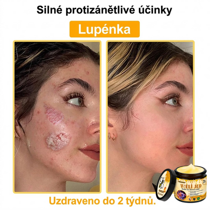 💖Dermatologicky a klinicky testováno👩‍⚕️LXNDS Bee Venom Krém na obnovení pleti🐝 pomáhá při léčbě kožních problémů, jako jsou: vrásky, jizvy, pigmentové skvrny, strie, akné, psoriáza, ekzém, kožní změny, podráždění, záněty a další kožní problémy.💖