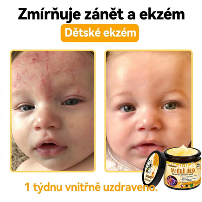 💖Dermatologicky a klinicky testováno👩‍⚕️LXNDS Bee Venom Krém na obnovení pleti🐝 pomáhá při léčbě kožních problémů, jako jsou: vrásky, jizvy, pigmentové skvrny, strie, akné, psoriáza, ekzém, kožní změny, podráždění, záněty a další kožní problémy.💖