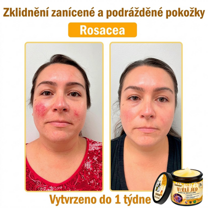 💖Dermatologicky a klinicky testováno👩‍⚕️LXNDS Bee Venom Krém na obnovení pleti🐝 pomáhá při léčbě kožních problémů, jako jsou: vrásky, jizvy, pigmentové skvrny, strie, akné, psoriáza, ekzém, kožní změny, podráždění, záněty a další kožní problémy.💖