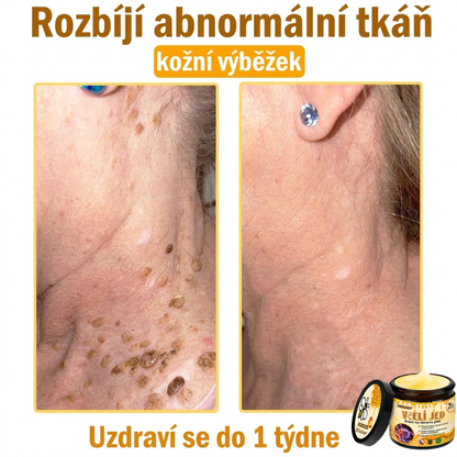 💖Dermatologicky a klinicky testováno👩‍⚕️LXNDS Bee Venom Krém na obnovení pleti🐝 pomáhá při léčbě kožních problémů, jako jsou: vrásky, jizvy, pigmentové skvrny, strie, akné, psoriáza, ekzém, kožní změny, podráždění, záněty a další kožní problémy.💖