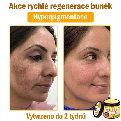 💖Dermatologicky a klinicky testováno👩‍⚕️LXNDS Bee Venom Krém na obnovení pleti🐝 pomáhá při léčbě kožních problémů, jako jsou: vrásky, jizvy, pigmentové skvrny, strie, akné, psoriáza, ekzém, kožní změny, podráždění, záněty a další kožní problémy.💖