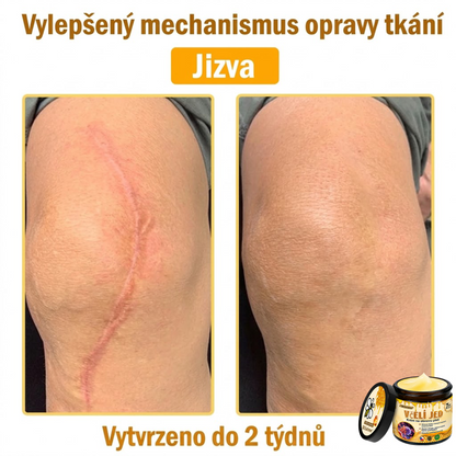 💖Dermatologicky a klinicky testováno👩‍⚕️LXNDS Bee Venom Krém na obnovení pleti🐝 pomáhá při léčbě kožních problémů, jako jsou: vrásky, jizvy, pigmentové skvrny, strie, akné, psoriáza, ekzém, kožní změny, podráždění, záněty a další kožní problémy.💖