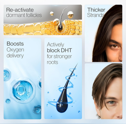 🔥NOW 50% OFF!! 🔥NEGUSY Hair Growth Serum Roll-On: 🌿The Scalp-Supporting Solution for Thicker, Fuller Hair✨