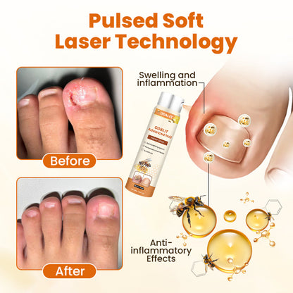 ODALIT Advanced Nail Repair Spray — Bee Venom Powered Nail Fungus Treatment | 60% OFF Today