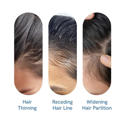 🔥NOW 50% OFF!! 🔥NEGUSY Hair Growth Serum Roll-On: 🌿The Scalp-Supporting Solution for Thicker, Fuller Hair✨
