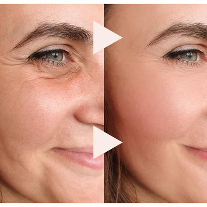 ✨Smooth Wrinkles in 10 Seconds with Instant Lift Anti-Wrinkle Serum — 🔥Glow Now & Save 70%