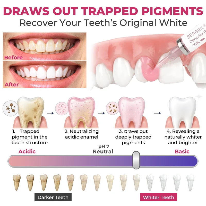 🦷 LXNDS DenPerm Cavity-Repair Natural Enamel Filling Gel